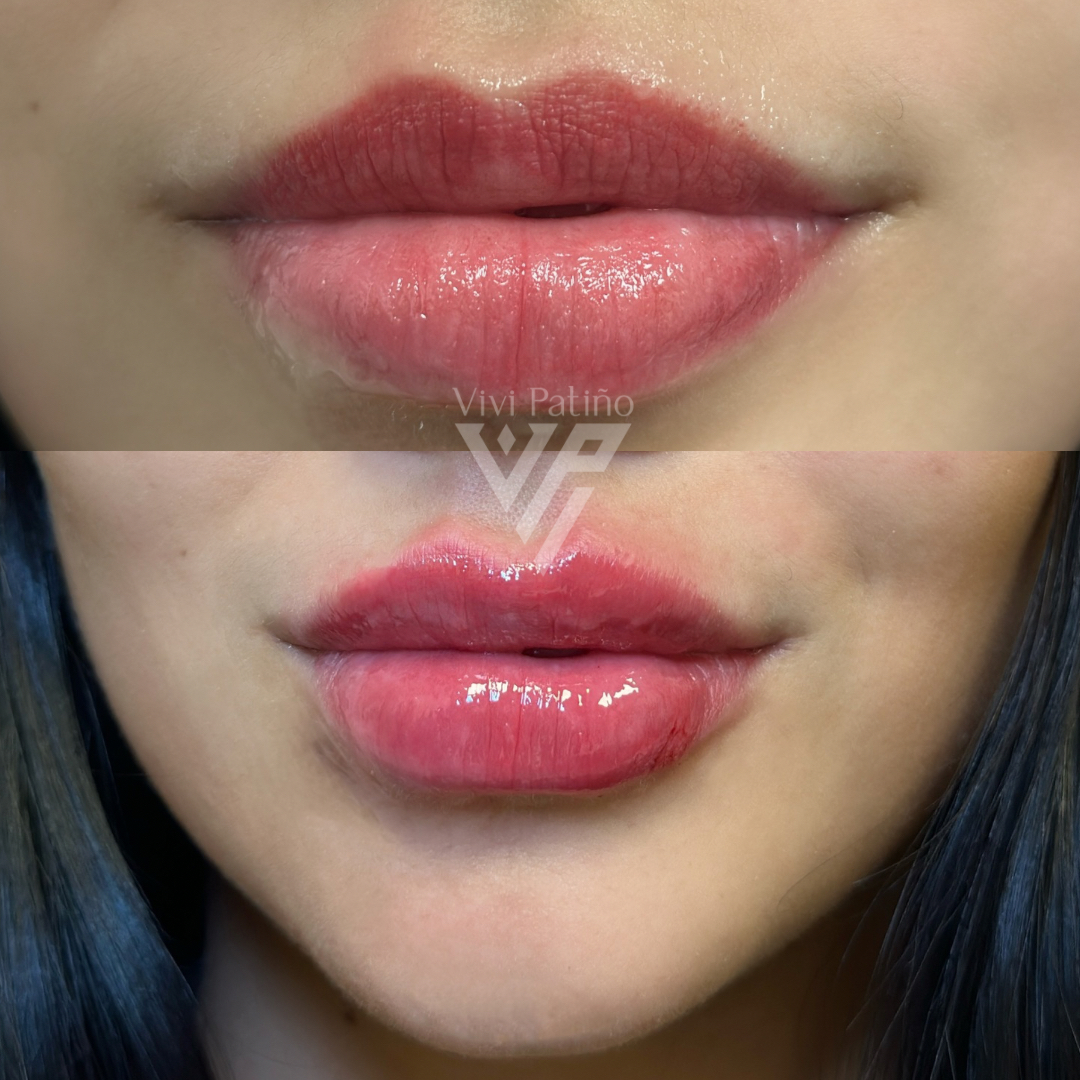 BRAT LIPS_6