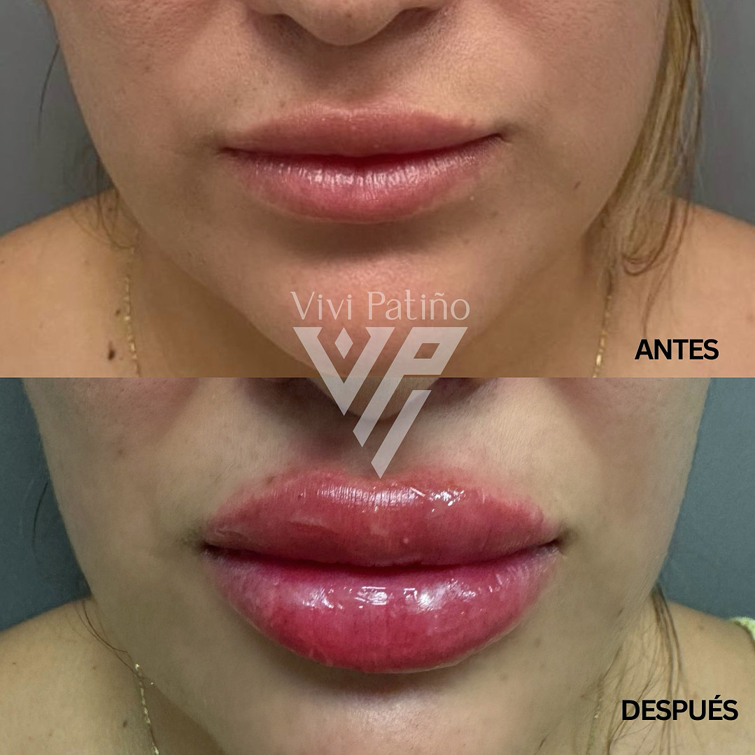 Copy of MONTAJE BEFORE AND AFTER – 6