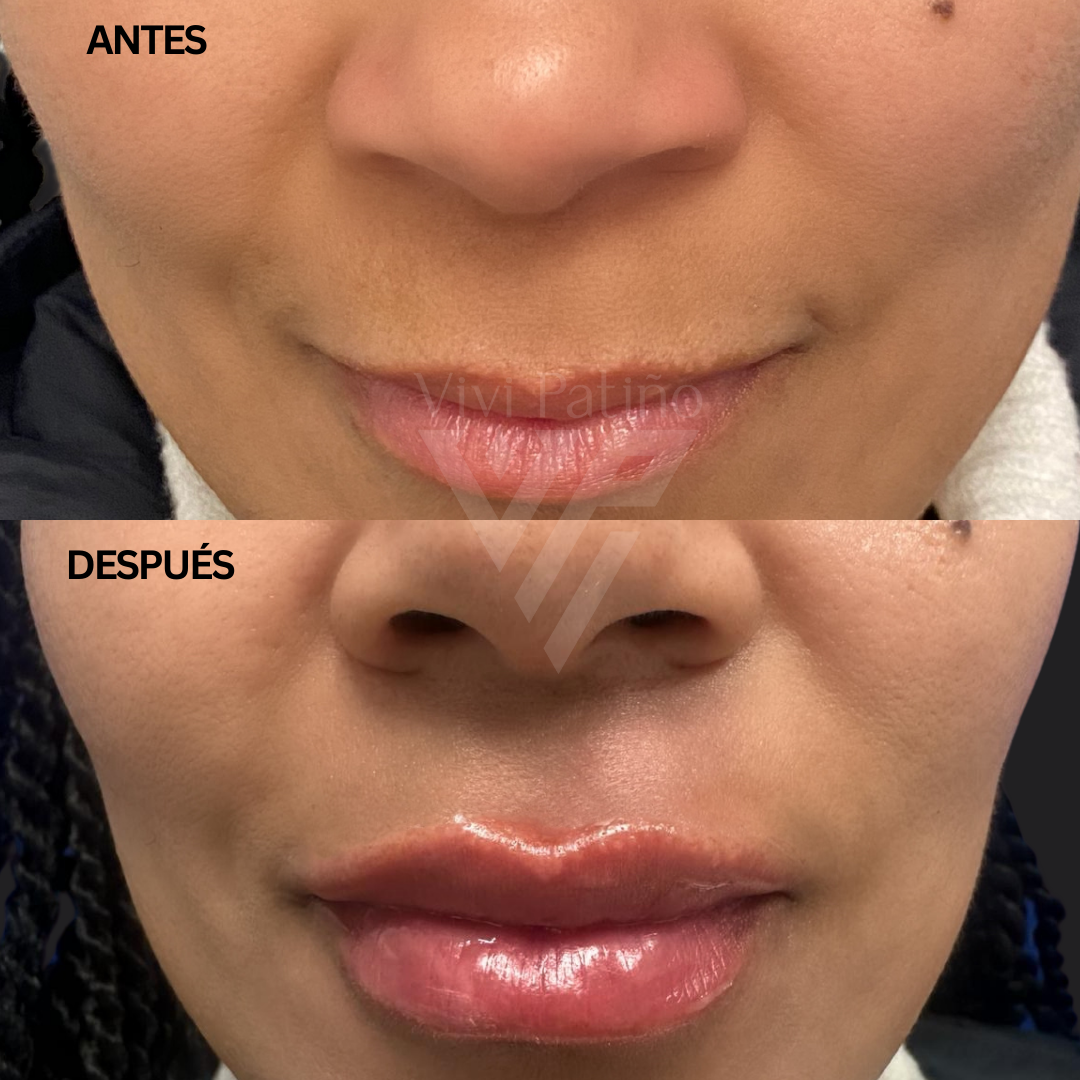 BRATZ LIPS_4