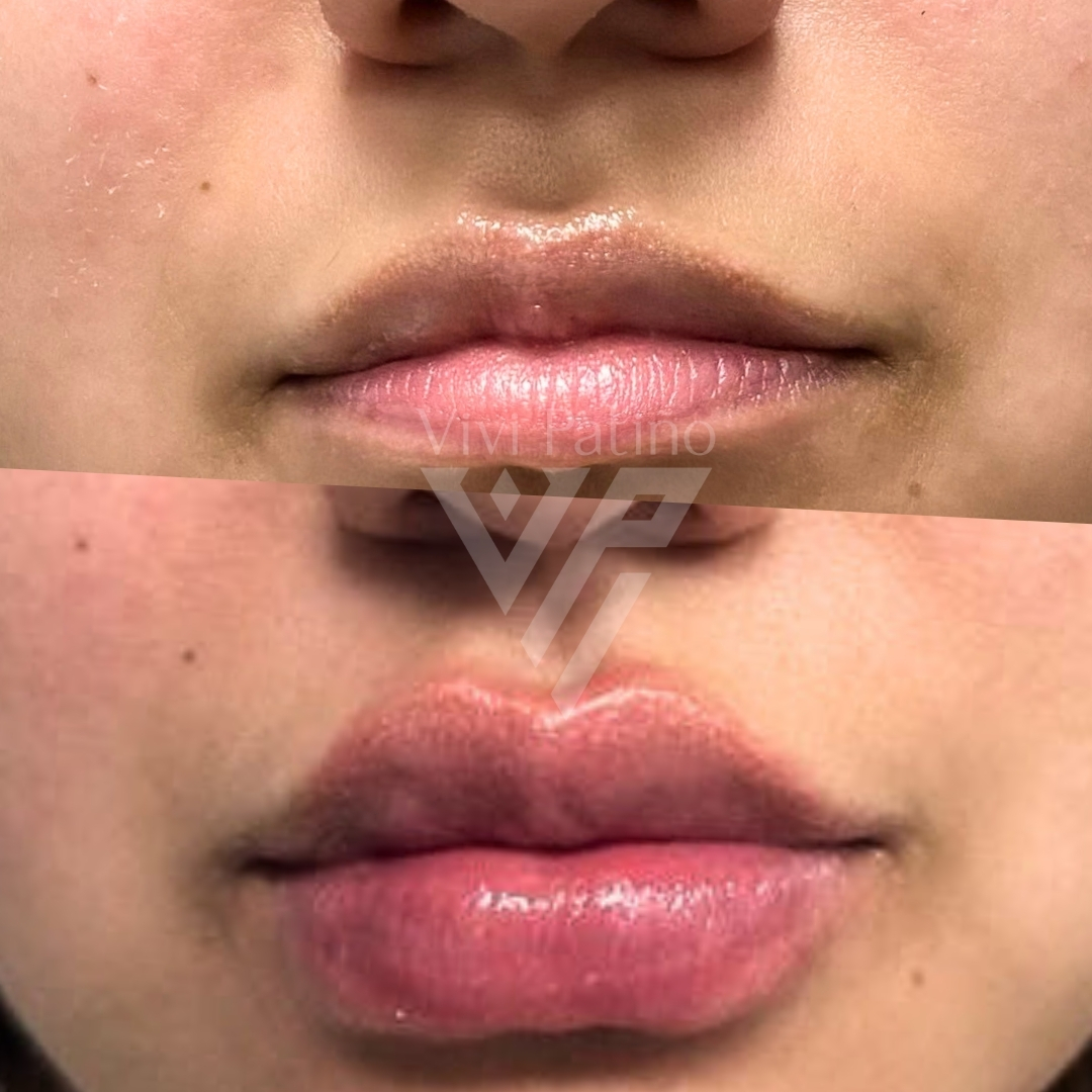 BRATZ LIPS_5