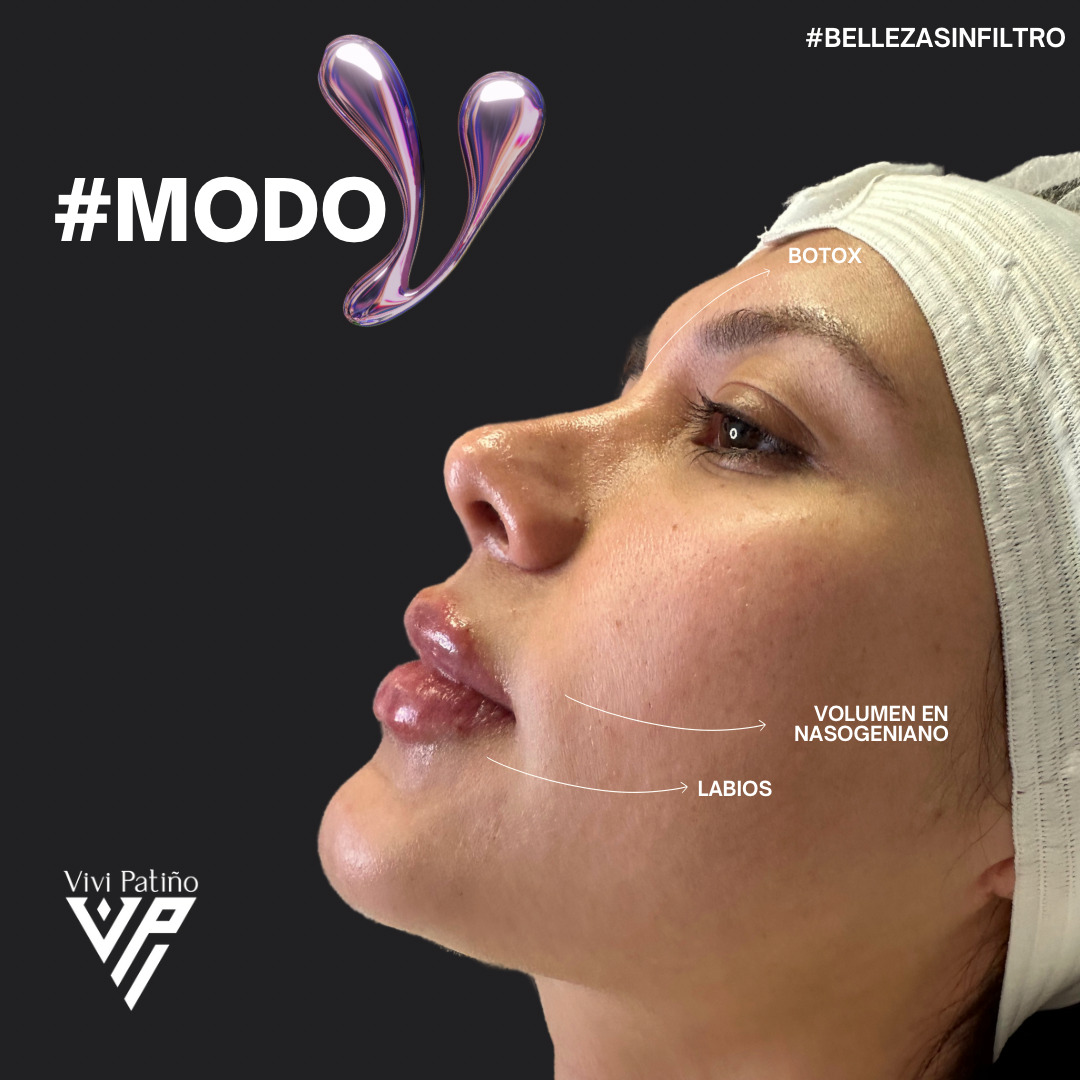 RINO MODELACION Y LABIOS