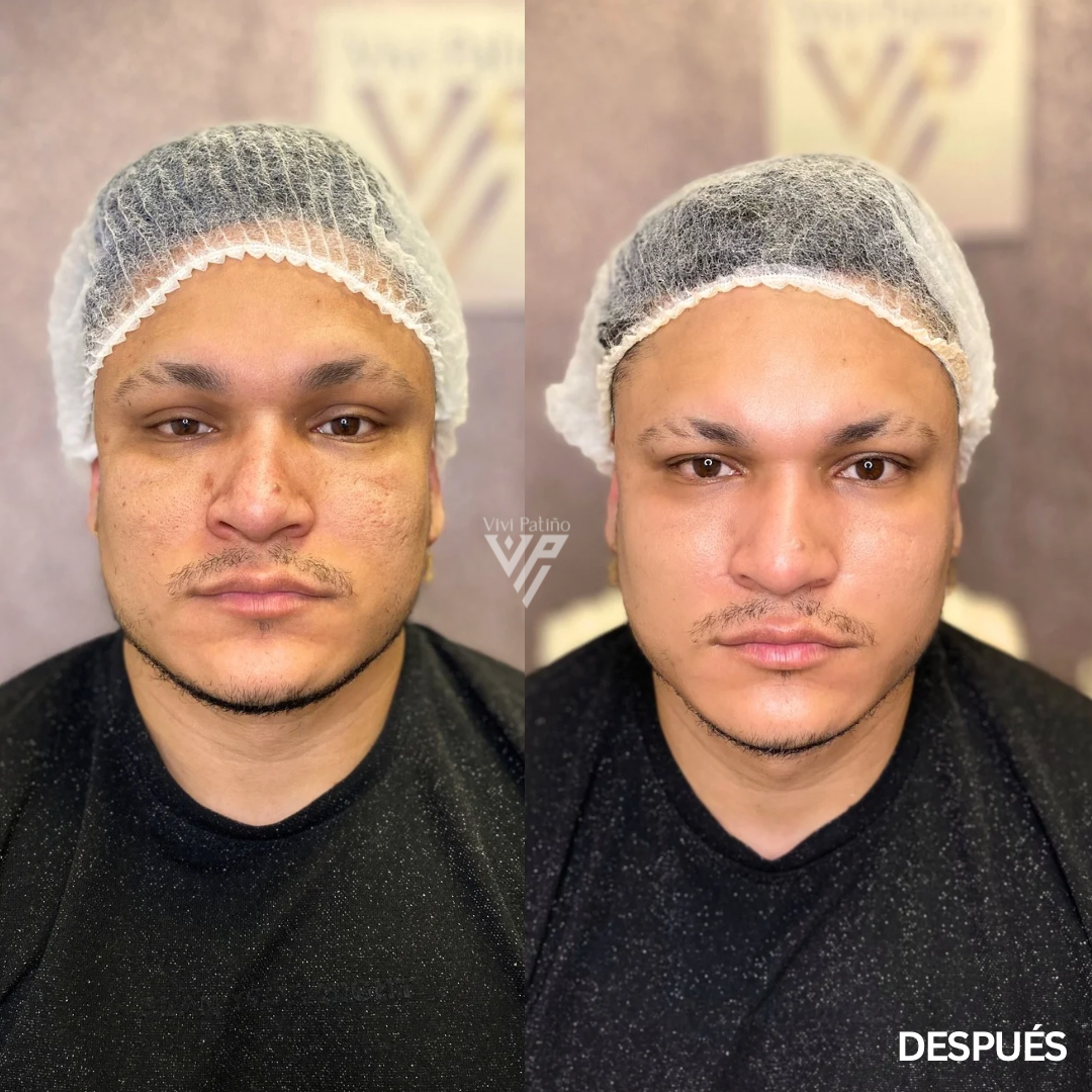SKIN CARE