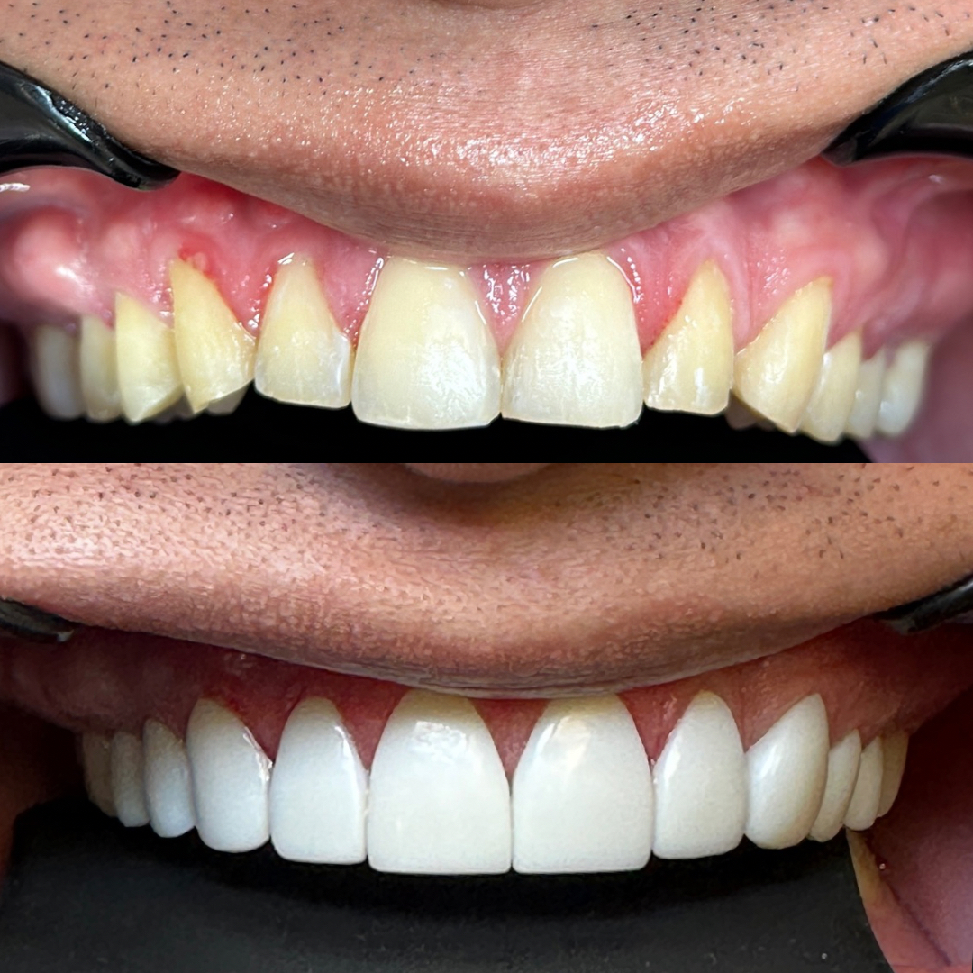 SMILE DESING