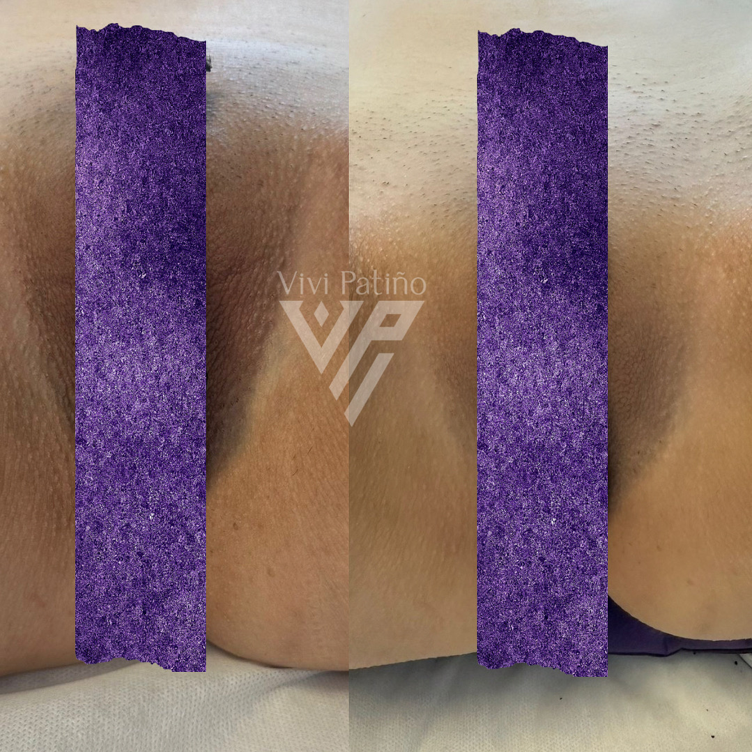 VULVA SPA_1